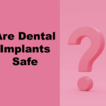 Are dental implants safe? Learn whether dental implants are safe, including risks, benefits, and who qualifies. Trusted dentist in Carson offering expert dental implant care.